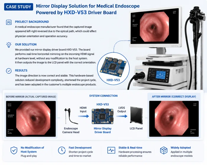 Case Study: Mirror Display Solution for Medical Endoscope by HXD-V53 LCD Driver Board with Image Mirror Display